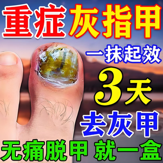 Onychomycosis special effective medicine for nail fungus infection removal, nail thickening and root cure i.originally imported from japan. a box of onychomycosis cream. special for bright onychomycosis. jingdong pharmacy