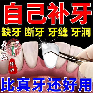 New tooth filling artifact material, self-filling tooth repair at home, self-filling repair resin, one bottle of tooth filling artifact, can fill 10 teeth
