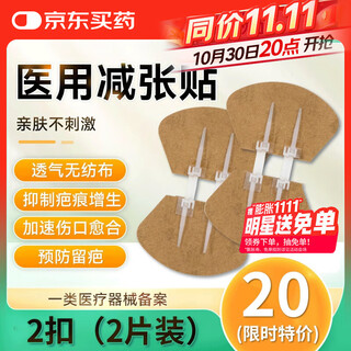 Gangnuo zippered band-aid skin tension reducer no needle needle-free elastic strap 2 buckles 2 pieces