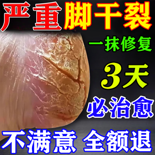 Petsochenke cracked foot cream anti-cracking cream for cracked and cracked heels, cracked and cracked hands and rough skin, self-moisturizing foot cream in a box, powerful and effective healing cream for cracked feet