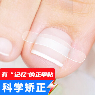 Aseblarm ingrown toenail correction nail patch, toenail patch, special foot groove foot patch for long nails, moderate memory type (obvious), no redness and swelling