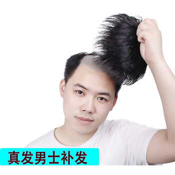 Tangni men's hair replacement wig cover head replacement forehead bald replacement hair pad hair extension flip cover wig real hair men's hair block hand-knitted head spin 14*14 short hair natural style