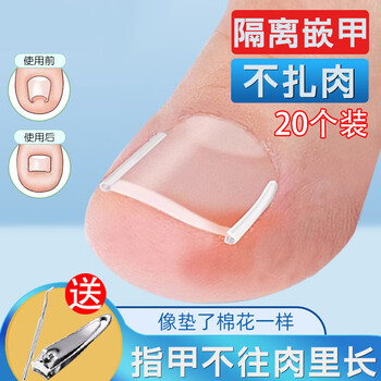 Haofanjie paronychia corrector, special correction artifact, nail spacer, toenail long in the flesh patch isolation pad, nail groove isolation pad 20 pieces