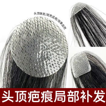 Delectable scar replacement patches for head scars, alopecia areata, burns and scars on the top of the head, customized biological scalp wig patches, black 15cm natural black, round diameter 3cm