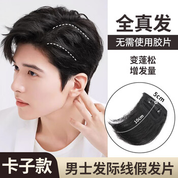 Cunning wig piece men's forehead replacement piece men's head bangs replacement hair pad hair piece boys side wig piece top of the head natural black one card 5*10cm
