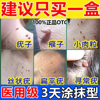 Chen gong vitamin a acid cream to remove warts, medical wart removal cream to remove warts, warts and flat warts, a smear of warts and warts to remove small fleshy particles on the neck, ointment for flat warts, filiform warts on the face, special medicine for the neck, 1 box, salicylic skin medicine, wart removal cream, 100% delivery, special effects, non-imported