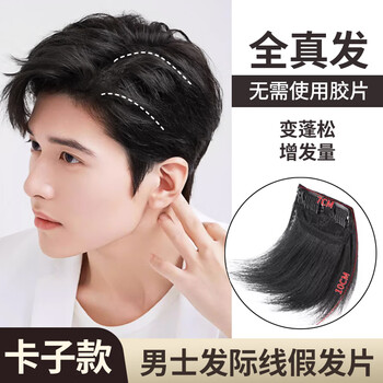 Cunning wig piece men's forehead replacement piece men's head bangs replacement hair pad hair piece boys side wig piece top natural black two card 7*10cm