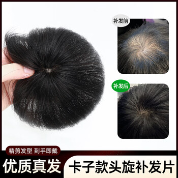 Ibeshi wig men's full real hair head twist hair seam scar replacement piece needle twist cover alopecia areata men's wig piece clip style 9x9 black hair length about 15cm