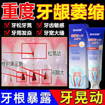 Miyamoto musashi's special toothpaste for gingival atrophy, periodontal tooth loosening, improvement of heavy bleeding between teeth, desensitizing toothpaste