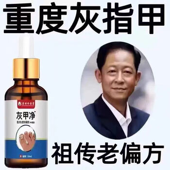 Toe cleansing, painless removal of onychomycosis, toe and finger thickening, antibacterial brightening liquid, anti-itching, general bumpy and turbidity, upgraded model, severe onychomycosis/none more