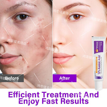 Azelaic acid 12% facial cream, moisturizing azelaic acid, one bottle