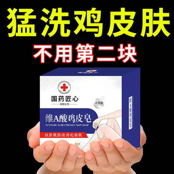 L0 herbal soap to remove goose skin pimples all over the body, hair follicles, horny legs, fish scales and snake skin moisturizing handmade soap. buy 2 and get 1 free. severe goose skin is completely improved.