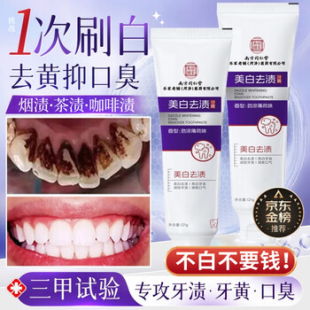 Tongrentang whitening toothpaste 121g removes bad breath, removes yellowing, removes tooth stains, removes tobacco stains, protects gums, freshens breath, and ranks first on the gold list