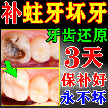 Hong kong pharmacy anti-cavity toothpaste, toothpaste for cavity repair and dental caries, special medicine for children to kill insects, repair cavities and clean decayed teeth. buy 2 get 1 free. special toothpaste for cavities and dental caries. hong kong pharmacy