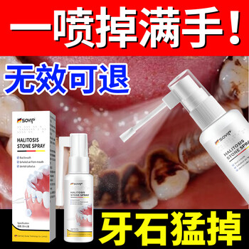 Sovip german dental calculus cleaning artifact, antibacterial, remove bad breath, remove dental calculus, remove yellow tooth stains, remove tobacco stains, remove scale and remove mouthwash