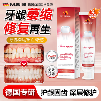 Falruier special toothpaste for gum protection, solidification and atrophy of gum i. exposed tooth root. repairs and regenerates loose tooth i. no. 1 on the gold list. loose tooth i does not shrink and does not recur. pack of four.
