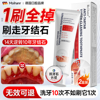Moihanr german dental calculus toothpaste inhibits bacteria and removes bad breath for adults, whitens, removes yellow and removes stains, brightens smoke stains and tartar cleaning artifact