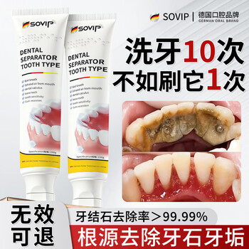 Sovip, germany's dental calculus cleaning artifact, inhibits bacteria, removes bad breath, removes yellow and removes tobacco stains, is the first in the gold list for non-toothpaste adults