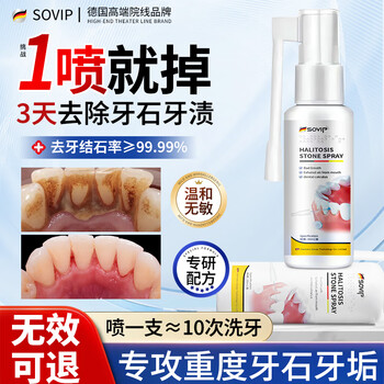 Sovip german dental calculus cleaning artifact, antibacterial, remove bad breath, remove dental calculus, remove yellow tooth stains, remove tobacco stains, remove scale and remove mouthwash