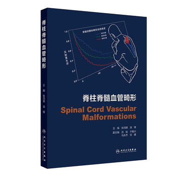 Spinal cord vascular malformation