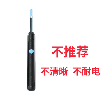 Yusenyi high-definition visual ear scoop home hospital luminous endoscope ear special ear picking tool for adults and children black standard version (standard definition pixel normal battery life) x1 box