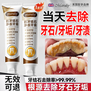 Mairulsy british dental calculus special toothpaste, antibacterial, remove bad breath, remove yellow, whiten, remove tooth stains, remove smoke stains, tartar solution*3