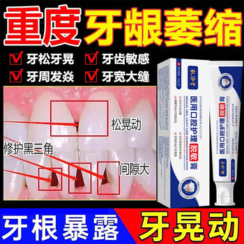 Hong kong jing peitang medical restoration artifact door improves teeth gaps and large corrects eating stuffed teeth correction gap filler toothpaste