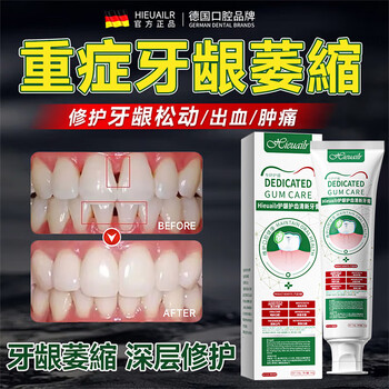 Hieuailr german special toothpaste for gums, atrophy repair, regeneration, exposed tooth roots, gum protection, tooth fixation, desensitization, top ten well-known brands