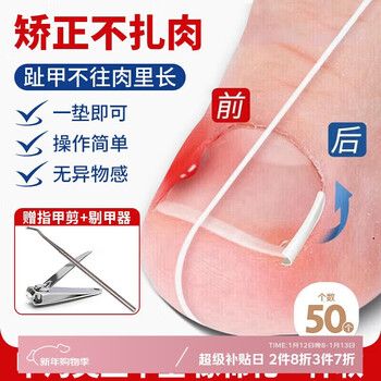 Hakkai bird paronychia correction toenail correction corrector isolation filling pad toenail long in the flesh trimming artifact