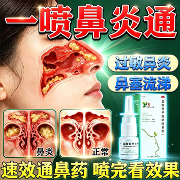 Changji oxymetazoline hydrochloride spray 10ml 1 box rhinitis medicine to treat allergic rhinitis sinusitis itchy nose and runny nose allergic rhinitis medicine nasal spray special effective medicine to clear the root, one spray to clear the nose, effective that night