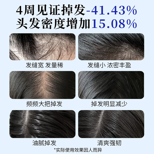 EHD防脱防断固发洗发水护发素洗护套装洗发水500ml+护发素400ml