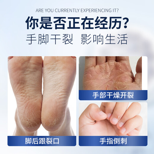 Ice King Skin Crack Cream 30g Cracked Hands and Feet Anti-Crack Cream Cracked Feet Cracked Hands Cracked Heels Cracked Cracked Foot Cream