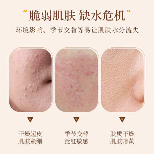 Luoyu Hangxi Astragalus Cream moisturizes and improves dullness, anti-wrinkle and firming skin, hydrating and moisturizing cream, old domestic product, brightens skin color for men and women 1 bottle [small trial]