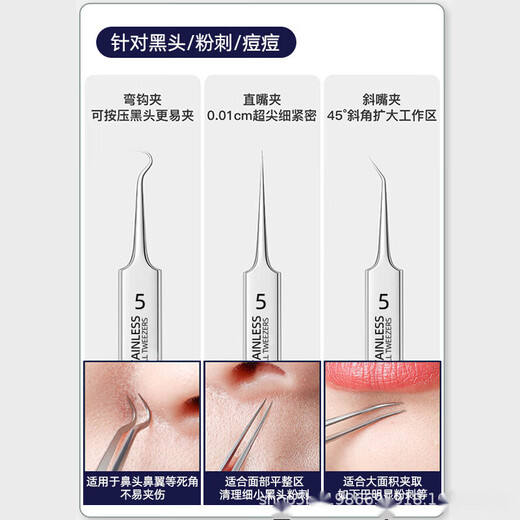 Chen Aishang acne clip, acne needle, scrape off blackhead clip tool, full set of cell clip, remove acne and blackhead, beauty salon style small tweezers, 1 piece, slanted mouth single, beauty salon style