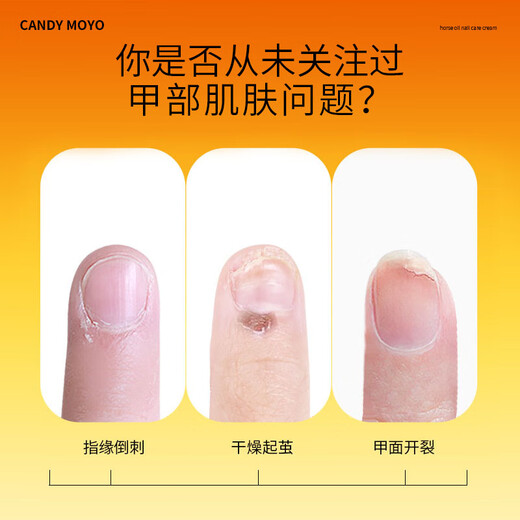CandyMoyo Finger Oil Nutrient Oil Care Brightening Nail Surface Reduces Barbs Horse Oil Armor Moisturizing Essence Hand Cream
