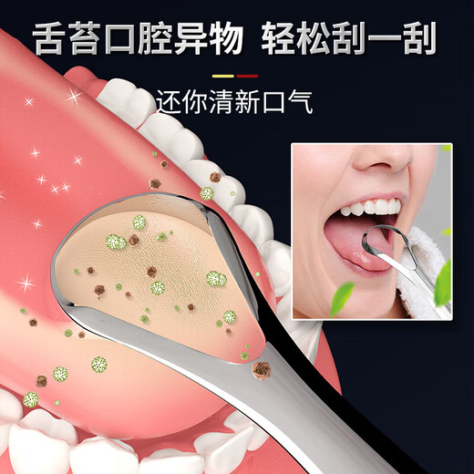 Medical grade 316 stainless steel tongue scraper cleaning device bad breath U-shaped oral cleaning tool set [German Seiko] Large mouth tongue scraper + storage box