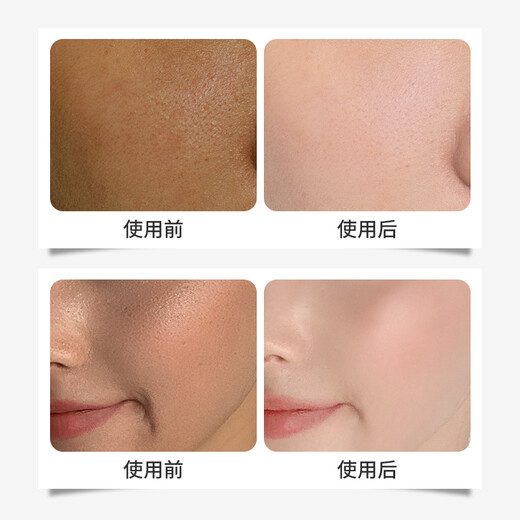 Zilai Niacinamida Emulsión blanqueadora de la piel Esencia Hidratante e iluminador Productos para el cuidado de la piel facial para hombres y mujeres, 2 botellas en total