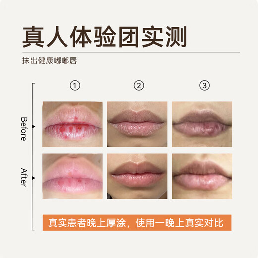 Jingzhou Sancao oil lip balm medical research moisturizing and diluting lip lines genuine men and women children chapped and peeling 8g