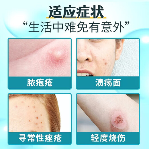 Erythromycin ointment Hongmeisu red ointment for men and women's private parts antibiotics acne pustules purulent burns ointment erythromycin ointment Confidential delivery 3 boxes Recurrent inflammation 17.5 average 5.8/box