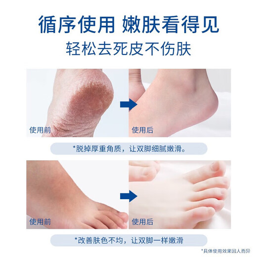 Sakose Vaseline Moisturizing and Repairing Foot Mask, a total of 3 packs of 6 pieces, exfoliates dead skin, rejuvenates cracked heels, moisturizes and hydrates