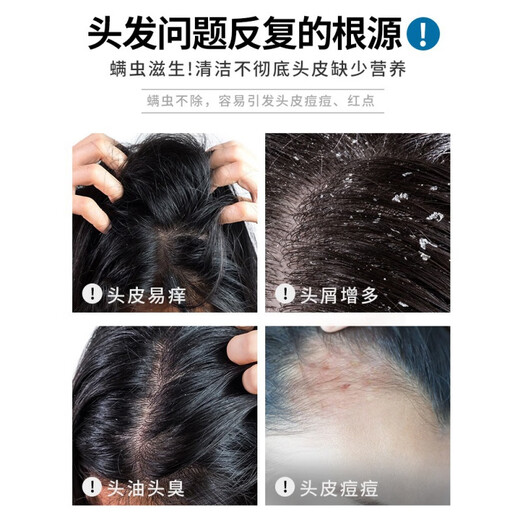 ALGN Amino Acid Purifying Shampoo 1000ml Long-lasting Fragrance Oil Control Fluffy Anti-Acne Shower Gel Set Amino Acid Sea Salt Purifying Shampoo 1 Bottle