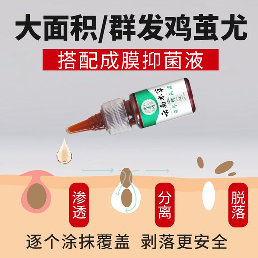 Chunchuntang Yunnan Herbal Corns Patch Hands and Feet Removes Warts, Plantars, Heels, Pads, Calluses, Thorns Monkey's Corns Cream