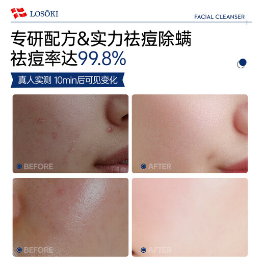 Losoki Switzerland imported anti-acne and mite cleansing milk amino acid for men and women to control oil, remove acne marks, blackheads and close pores cleansing milk, double acne removal, facial cleansing milk 200ml*2