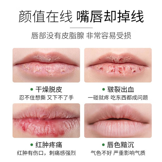 sakose凡士林洋甘菊润唇膏两支装共5.6g四季防干裂脱皮舒缓修护双唇男女