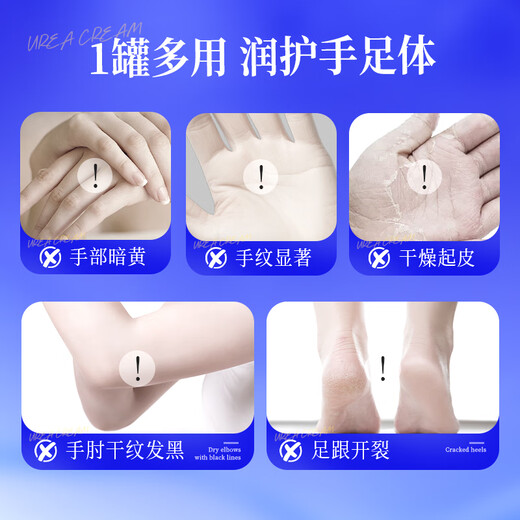 Beijing Tong Ren Tang urea cream vitamin E cream for dry skin, moisturizing and moisturizing body cream for dry skin.