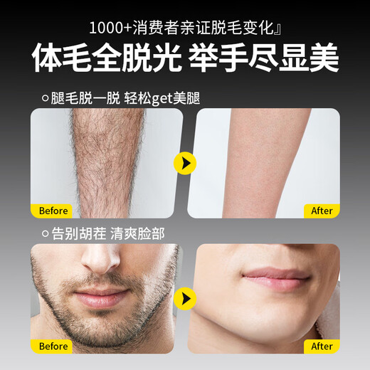 MUESRGTEI German high-end hair removal cream for men's private parts, beard, armpits, lips, face, armpit hair, leg hair, chest sweat, whole body private parts