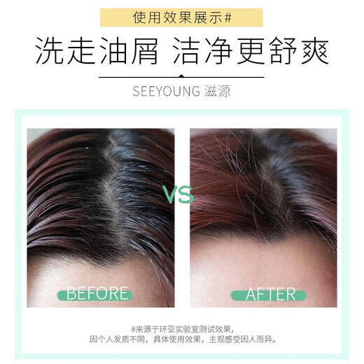 滋源净屑香氛洗发水森林曦风无硅油洗头水控油清爽去屑男女士535ml