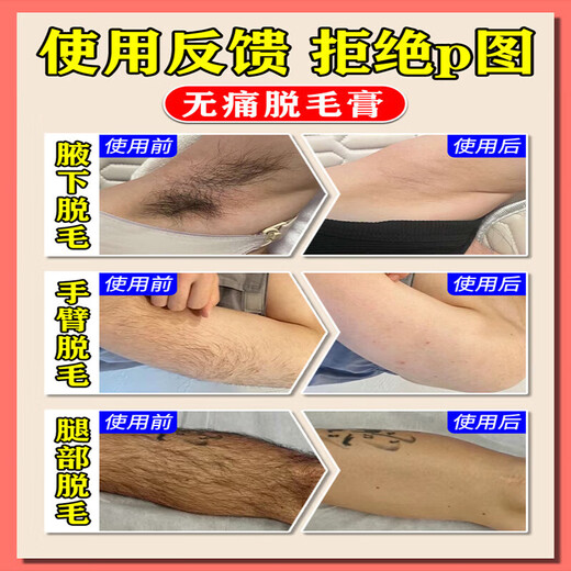 Hair removal cream permanently removes beards, armpits, private parts and anus for men and women. It leaves no black spots and never grows. Buy 2 get 1 free. Treatment package. 99% of customers choose it.