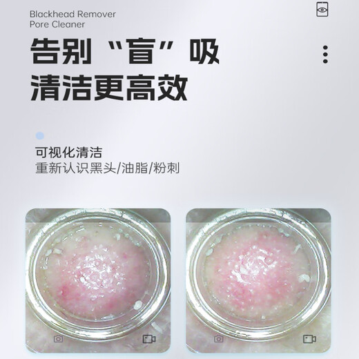M arlincare visual ice hot compress blackhead extractor blackhead cleaning artifact cleaner blackhead suction instrument beauty instrument Yunqinglan ice hot compress + visual