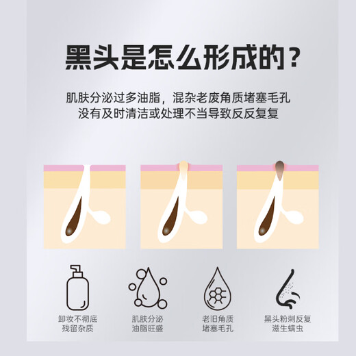 M arlincare visual ice hot compress blackhead extractor blackhead cleaning artifact cleaner blackhead suction instrument beauty instrument Yunqinglan ice hot compress + visual